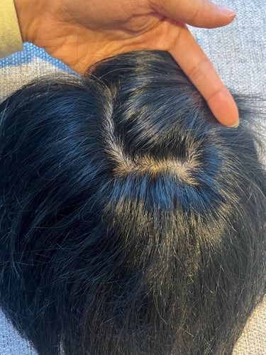 Mens Hair patch| Hair N Care - Image 4