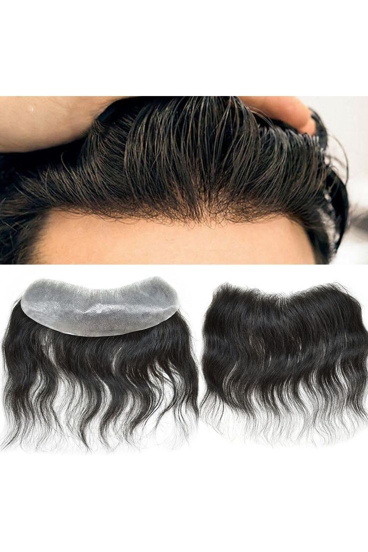 Forhead patch| Hair N Care