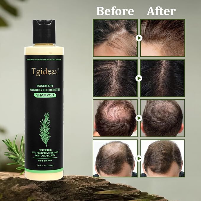 Organic rosemarry hair growth shampoo | Hair N Care