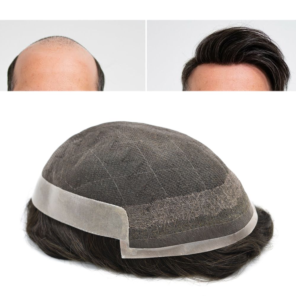 Crown Hair Patch| Hair N Care - Image 3